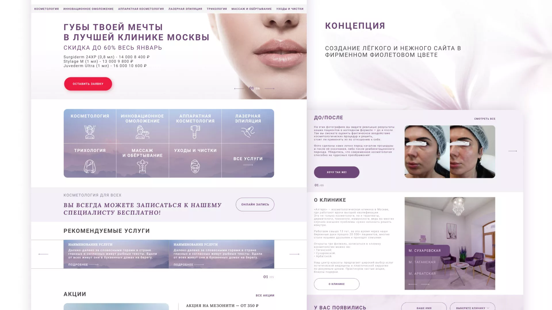 Создание сайта сети клиник эстетической косметологии «Алтеро» в Вятских Полянах